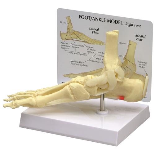 Modell des Fußes/Knöchels mit Plantarfasziitis, 1019522, Fuß- und Beinskelett Modelle