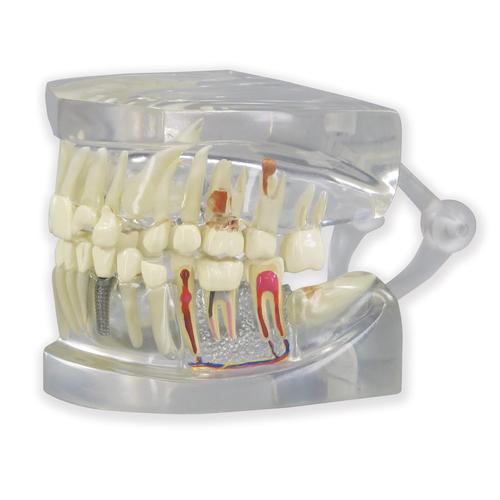 Durchsichtiger menschlicher Kiefer mit Zahnmodell, 1019540, Zahnmodelle