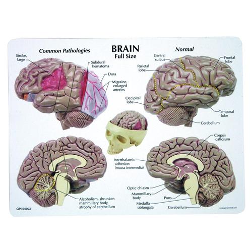 Gehirnmodell, 1019542, Schädelmodelle