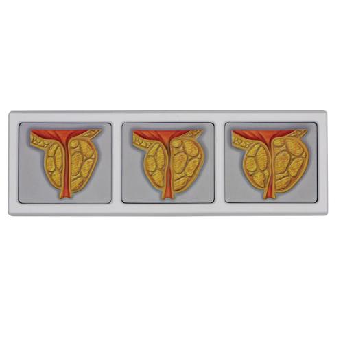 Männliches Becken mit 3D-Prostata-Rahmen, 1019563, Genital- und Beckenmodelle