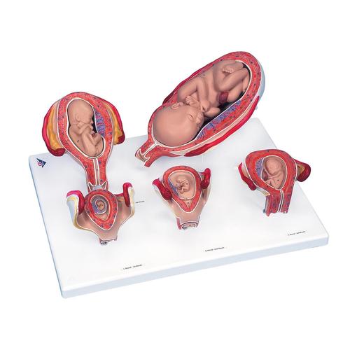 Schulungsset Einführung in die Geburtshilfe, 8000877 [3011904], Simulation Sets