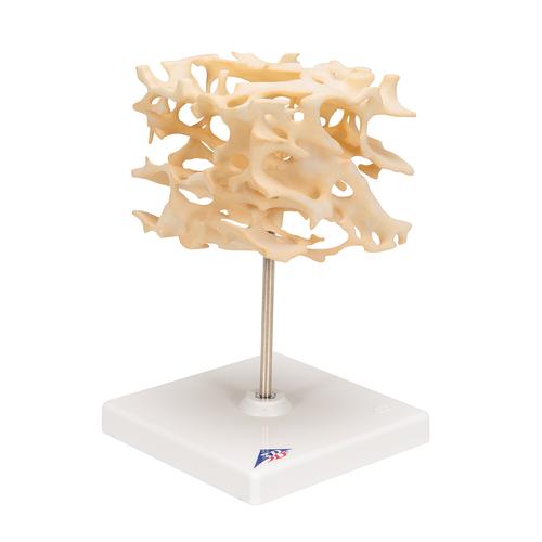 Knochenspongiosa (Schwammknochen) Modell, 100-fach vergrößert - 3B Smart Anatomy, 1009698 [A99], Einzelne Knochenmodelle
