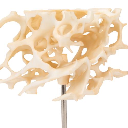 Knochenspongiosa (Schwammknochen) Modell, 100-fach vergrößert - 3B Smart Anatomy, 1009698 [A99], Einzelne Knochenmodelle