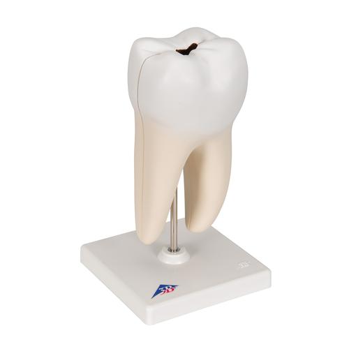 Zahn Modell Unterer Zweiwurzeliger Molar mit Karies, 2-teilig - 3B Smart Anatomy, 1000243 [D10/4], Ersatzteile