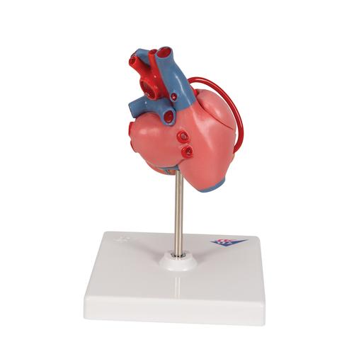 Herzmodell "Klassik" mit Bypass, 2-teilig - 3B Smart Anatomy, 1017837 [G05], Herzgesundheit und Fitnesserziehung