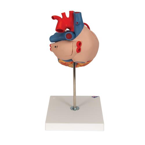 Herzmodell mit Bypass, 2-fache Größe, 4-teilig - 3B Smart Anatomy, 1000263 [G06], Herz- und Kreislaufmodelle