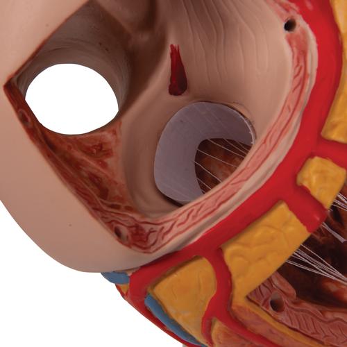 Herzmodell, 2-fache Größe, 4-teilig - 3B Smart Anatomy, 1000268 [G12], Herz- und Kreislaufmodelle