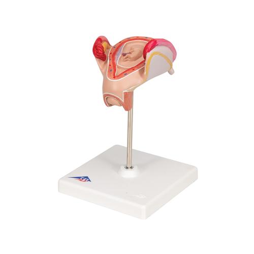 Embryo Modell, 2. Monat - 3B Smart Anatomy, 1000323 [L10/2], Mensch