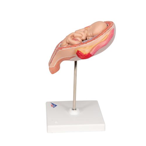 Fetus Modell, 5. Monat, Steißlage - 3B Smart Anatomy, 1018630 [L10/5], Schwangerschaft