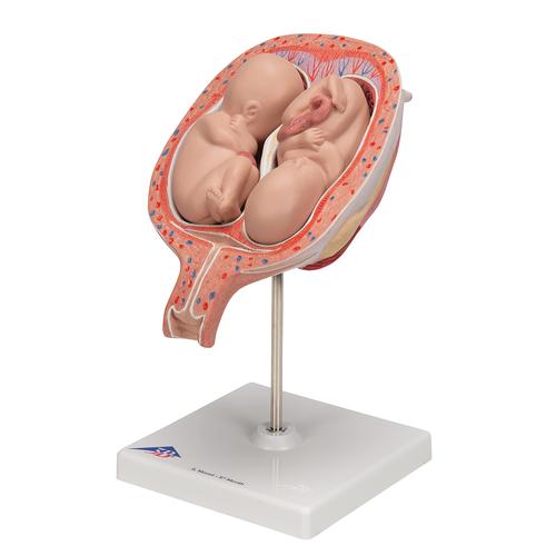 Zwillingsfeten Modell, 5. Monat, normale Position - 3B Smart Anatomy, 1000328 [L10/7], Schwangerschaft