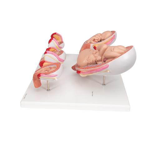 Schwangerschaftsmodell Serie, 5 Modelle - 3B Smart Anatomy, 1018633 [L11/9], Schwangerschaft