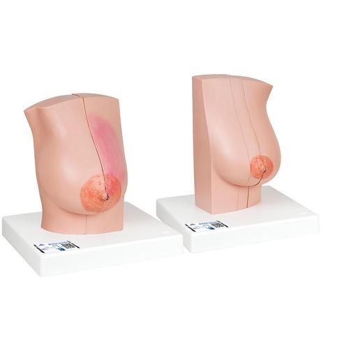 Weibliches Brustmodell - 3B Smart Anatomy, 1008497 [L56], Gesundheitserziehung - Frau
