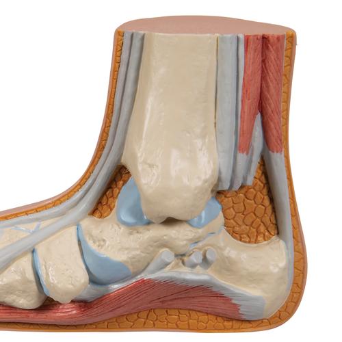 Fußmodell Plattfuß (Pes planus) - 3B Smart Anatomy, 1000355 [M31], Gelenkmodelle