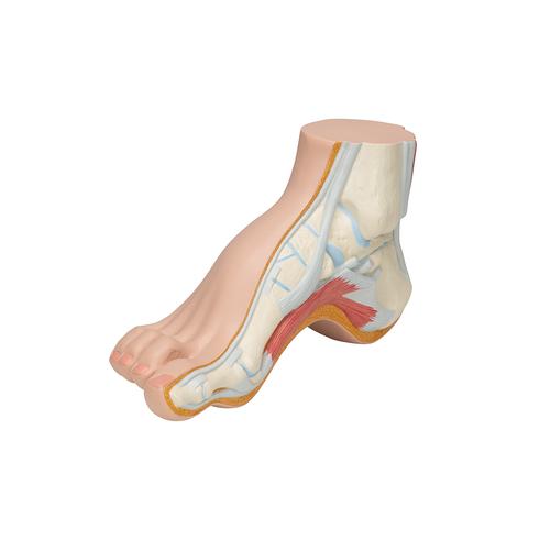 Fußmodell Hohlfuß (Pes cavus) - 3B Smart Anatomy, 1000356 [M32], Gelenkmodelle