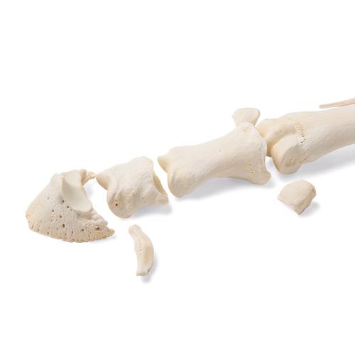 Pferd Mittelfußknochen, 1021068 [T30069], Osteologie