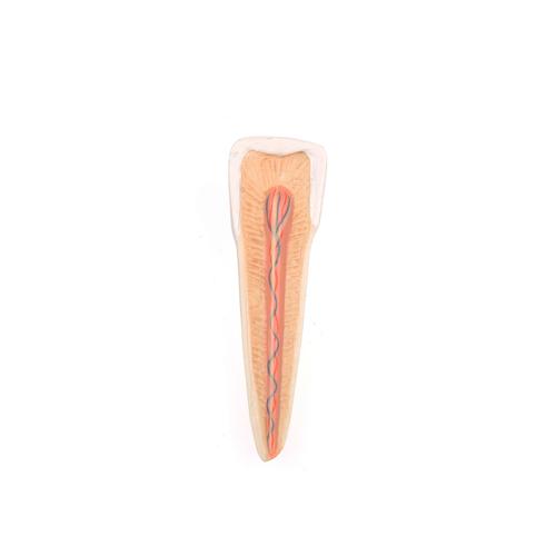 Unterkieferhälfte Modell mit 8 kariösen Zähnen, 19-teilig - 3B Smart Anatomy, 1001250 [VE290], Zahnmodelle