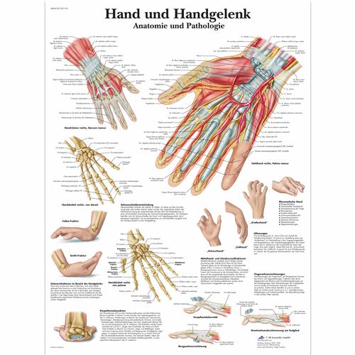 Lehrtafel - Hand und Handgelenk - Anatomie und Pathologie, 1001318 [VR0171L], Skelettsystem