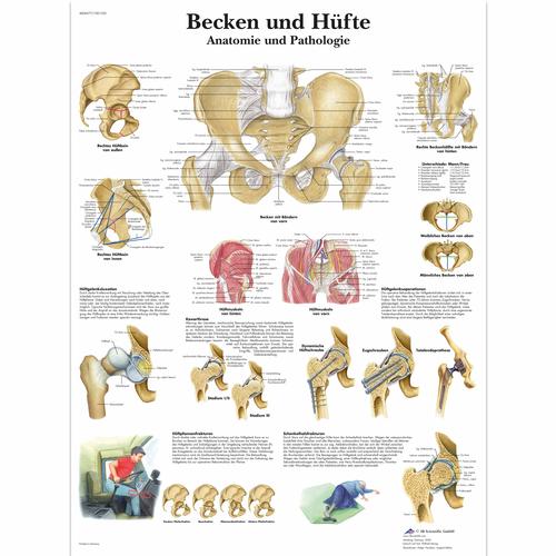 Lehrtafel - Becken und Hüfte - Anatomie und Pathologie, 4006577 [VR0172UU], Skelettsystem
