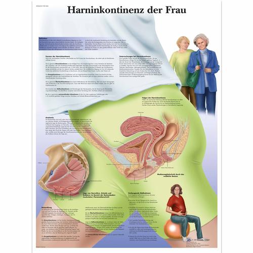 Lehrtafel - Harninkontinenz der Frau, 4006620 [VR0542UU], Gynäkologie