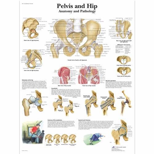 Lehrtafel - Pelvis and Hip - Anatomy and Pathology, 4006660 [VR1172UU], Skelettsystem