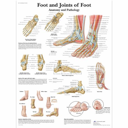 Lehrtafel - Foot and Joints of Foot - Anatomy and Pathology, 4006662 [VR1176UU], Skelettsystem