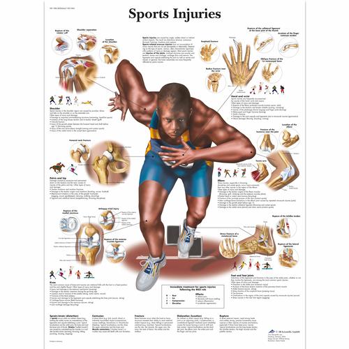 Lehrtafel - Sports Injuries, 4006664 [VR1188UU], Muskel
