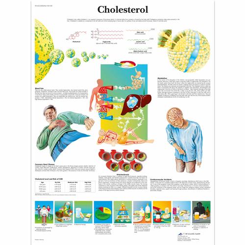 Lehrtafel - Cholesterol, 1001558 [VR1452L], Herz-Kreislauf-System