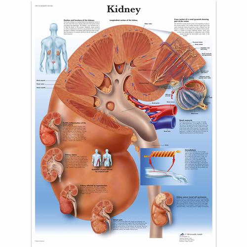 Lehrtafel - Kidney, 4006699 [VR1515UU], Stoffwechselsystem