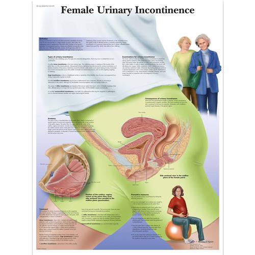 Lehrtafel - Female Urinary Incontinence, 1001570 [VR1542L], Gynäkologie