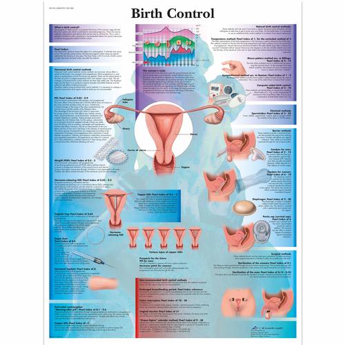 Lehrtafel - Birth Control, 1001580 [VR1591L], Gynäkologie