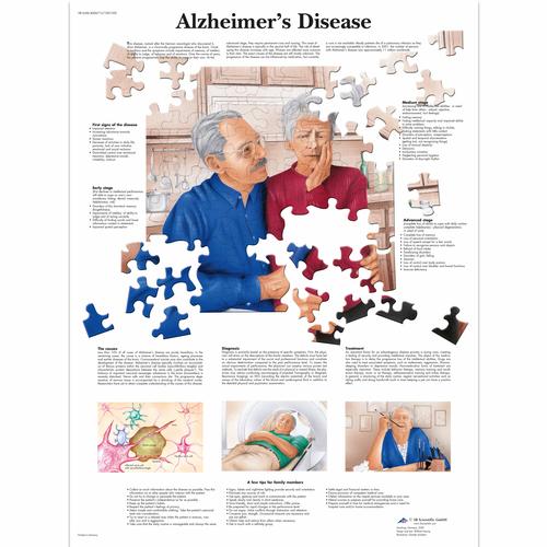 Lehrtafel - Alzheimer's Disease, 1001592 [VR1628L], Gehirn und Nervensystem