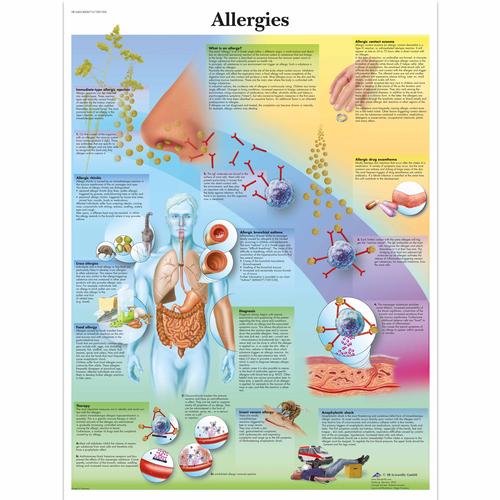 Lehrtafel - Allergies, 1001596 [VR1660L], Asthma und Allergien
