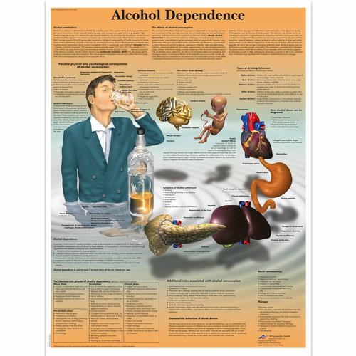 Alcohol Dependence, 1001620 [VR1792L], Drogen und Alkohol Aufklärung