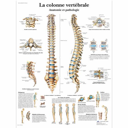 Lehrtafel - La colonne vertébrale, Anatomie et pathologie, 4006739 [VR2152UU], Skelettsystem