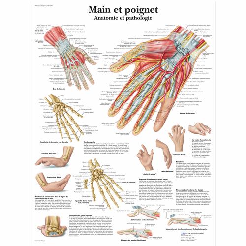 Lehrtafel - Main et poignet - Anatomie et pathologie, 1001648 [VR2171L], Skelettsystem
