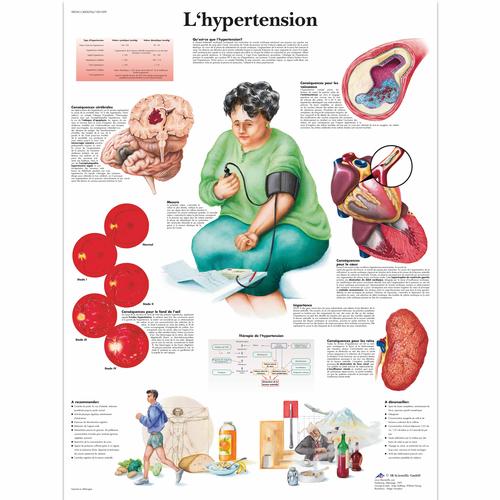Lehrtafel - L'hypertension, 1001699 [VR2361L], Herz-Kreislauf-System