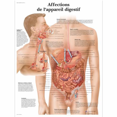 Lehrtafel - Affections de L'appareil digestif, 4006774 [VR2431UU], Verdauungssystem
