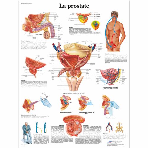 Lehrtafel - La prostate, 1001733 [VR2528L], Harnsystem