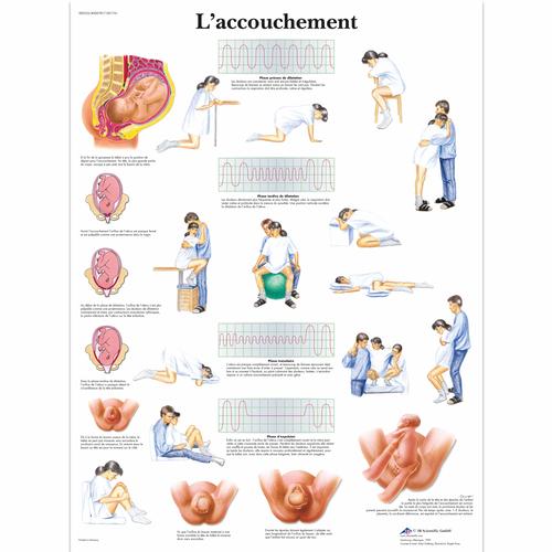 Lehrtafel - L'accouchement, 1001741 [VR2555L], Schwangerschaft und Geburt
