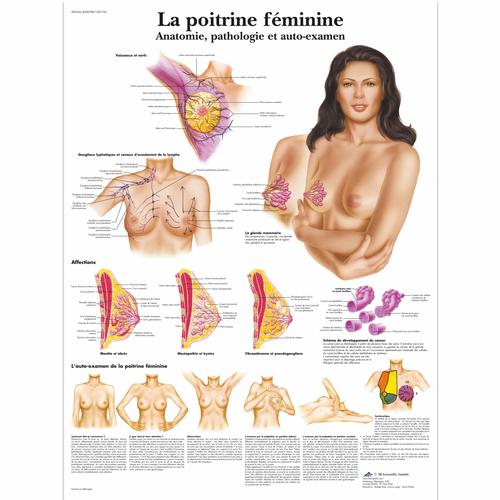 Lehrtafel - La poitrine féminine - Anatomie, pathologie et auto-examen, 1001743 [VR2556L], Gynäkologie
