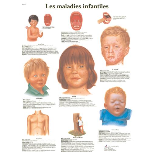 Lehrtafel - Les maladies infantiles, 1001780 [VR2741L], Parasitäre, virale oder bakterielle Infektion