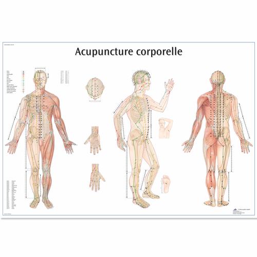 Lehrtafel - Acupuncture corporelle, 4006812 [VR2820UU], Akupunktur Modelle und Lehrtafeln
