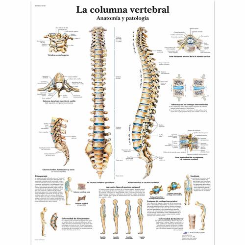 Lehrtafel - La columna vertebral - Anatomía y patología, 1001811 [VR3152L], Skelettsystem