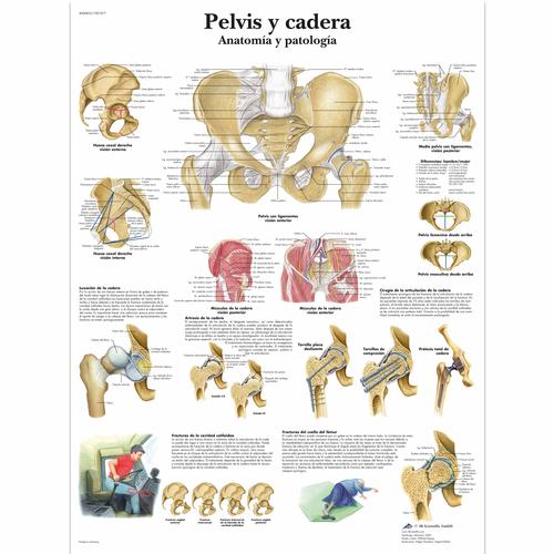 Lehrtafel - Pelvis y cadera - Anatomía y patología, 1001817 [VR3172L], Skelettsystem