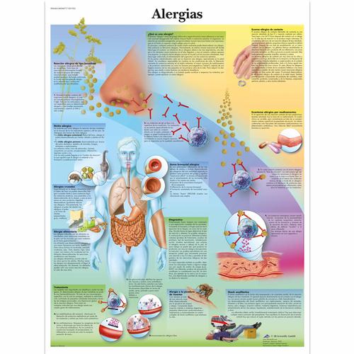 Lehrtafel - Alergias, 1001925 [VR3660L], Immunsystem