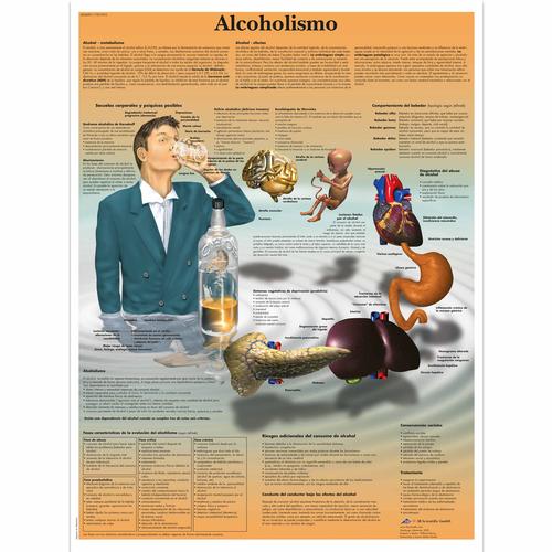 Lehrtafel - Alcoholismo, 4006891 [VR3792UU], Sucht