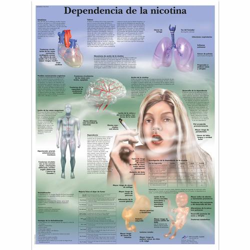 Lehrtafel - Dependencia de la nicotina, 1001955 [VR3793L], Gefahren des Rauchens