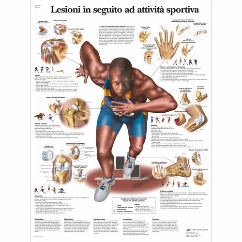 Lehrtafel - Lesioni in seguito ad attivitá sportiva, 1001991 [VR4188L], Muskel
