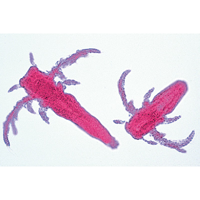 Krebstiere (Crustacea) - Deutsch, 1003859 [W13004], Mikropräparate LIEDER