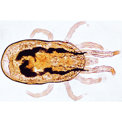 Spinnentiere und Tausendfüssler (Arachnoidea, Myriapoda) - Deutsch, 1003863 [W13005], Mikropräparate LIEDER